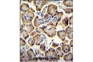 RADIL antibody (C-term) (ABIN654195 and ABIN2844045) immunohistochemistry analysis in formalin fixed and paraffin embedded human pancreas tissue followed by peroxidase conjugation of the secondary antibody and DAB staining. (Radil Antikörper  (C-Term))