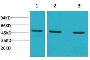 Western Blotting (WB) image for anti-Mitogen-Activated Protein Kinase Kinase 5 (MAP2K5) antibody (ABIN3179102)