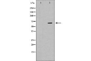 Western blot analysis of A431  lysate using RPA1 antibody.