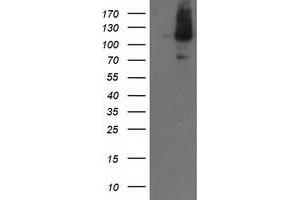 Western Blotting (WB) image for anti-Excision Repair Cross-Complementing Rodent Repair Deficiency, Complementation Group 4 (ERCC4) antibody (ABIN1498071) (ERCC4 Antikörper)