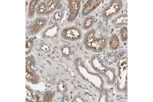 Immunohistochemical staining (Formalin-fixed paraffin-embedded sections) of human kidney with SHOC2 polyclonal antibody  shows moderate cytoplasmic positivity in cells in tubules. (SHoc2/Sur8 Antikörper  (AA 455-562))