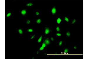 Immunofluorescence of monoclonal antibody to ID3 on HeLa cell.