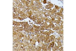 Immunohistochemistry of paraffin-embedded rat liver using Septin 4 antibody (ABIN6128476, ABIN6147554, ABIN6147555 and ABIN6214410) at dilution of 1:100 (40x lens). (Septin 4 Antikörper  (AA 1-100))