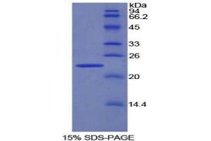 SDS-PAGE analysis of Rat Pronociceptin Protein. (Pronociceptin Protein)