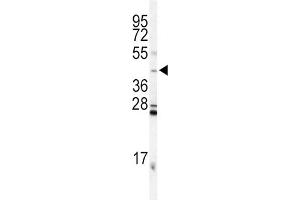 Western Blotting (WB) image for anti-Inhibin, alpha (INHA) antibody (ABIN3002774) (Inhibin alpha Antikörper)