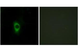 Immunofluorescence analysis of HeLa cells, using 5-HT-2B Antibody. (Serotonin Receptor 2B Antikörper  (AA 261-310))