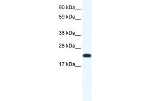 WB Suggested Anti-CITED4 Antibody Titration:  1. (CITED4 Antikörper  (N-Term))