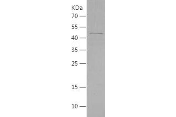 RCN2 Protein (AA 26-317) (His tag)