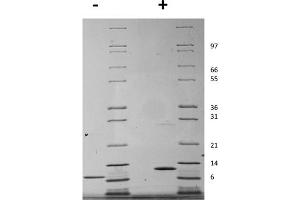 SDS-PAGE of Mouse Interleukin-15 Recombinant Protein SDS-PAGE of Mouse Interleukin-15 Recombinant Protein. (IL-15 Protein)
