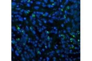 IF analysis of CD68 using anti-CD68 antibody (ABIN7600142). (CD68 Antikörper  (AA 154-354))