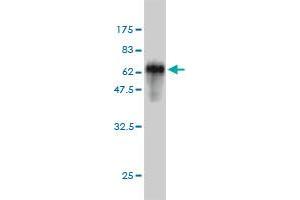 Western Blotting (WB) image for anti-Sprouty Homolog 2 (SPRY2) (AA 1-315) antibody (ABIN564439)