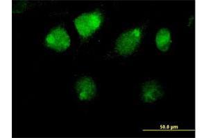 Immunofluorescence of purified MaxPab antibody to ZBTB26 on HeLa cell. (ZBTB26 Antikörper  (AA 1-441))