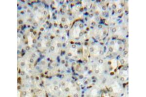 Used in DAB staining on fromalin fixed paraffin-embedded Kidney tissue (PIN1 Antikörper  (AA 2-163))