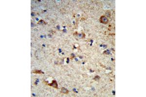 Formalin-fixed and paraffin-embedded human brain tissue reacted with EXT2 Antibody (Center), which was peroxidase-conjugated to the secondary antibody, followed by DAB staining. (EXT2 Antikörper  (AA 182-209))