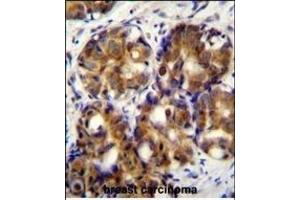 Immunohistochemistry (Paraffin-embedded Sections) (IHC (p)) image for anti-Hyaluronan-Mediated Motility Receptor (RHAMM) (HMMR) (AA 668-697), (C-Term) antibody (ABIN655716)