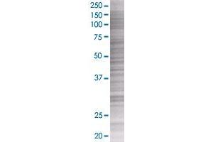 FAS transfected lysate. (FAS 293T Cell Transient Overexpression Lysate(Denatured))