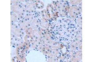 Used in DAB staining on fromalin fixed paraffin- embedded kidney tissue (KNG1 Antikörper  (AA 19-380))