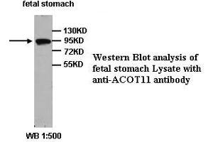 Image no. 1 for anti-Acyl-CoA Thioesterase 11 (ACOT11) (Internal Region) antibody (ABIN791080)
