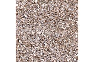 IHC analysis of TRMT61A using anti-TRMT61A antibody (ABIN7599220).