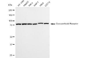 Western blotting analysis using Glucocorticoid Receptor antibody (ABIN7799657).