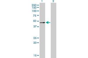 Western Blot analysis of SERPINA12 expression in transfected 293T cell line by SERPINA12 MaxPab polyclonal antibody. (SERPINA12 Antikörper  (AA 1-414))
