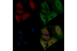 ABIN6258416 and ABIN6274632 staining  cells by IF/ICC.