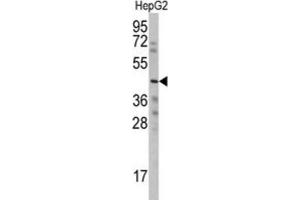 Western Blotting (WB) image for anti-Wnt1 Inducible Signaling Pathway Protein 3 (WISP3) antibody (ABIN3002571)
