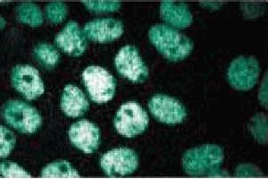 Immunofluorescence staining of A431 cells (Human epithelial carcinoma, ATCC CRL-1555). (CTCF Antikörper  (AA 184-290))