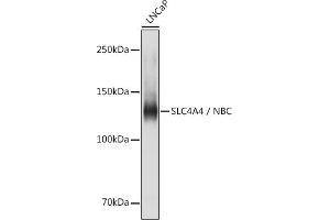 Western blot analysis of extracts of LNCaP cells, using SLC4 / NBC antibody (ABIN6129130, ABIN6148013, ABIN6148014 and ABIN6220962) at 1:1000 dilution. (SLC4A4 Antikörper  (AA 1-240))