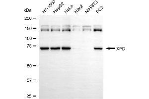 Western blotting analysis using XPD antibody (ABIN7798540). (Rekombinanter ERCC2 Antikörper)