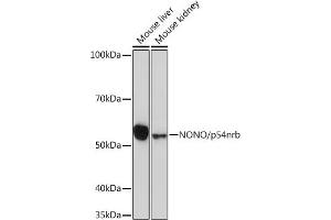 Western blot analysis of extracts of various cell lines, using NONO/p54nrb Rabbit mAb (ABIN7268947) at 1:1000 dilution. (NONO Antikörper)