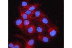 IF analysis of RPS5 using anti-RPS5 antibody (ABIN7599076). (RPS5 Antikörper  (AA 1-204))
