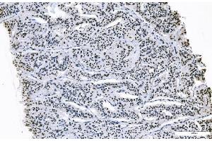 IHC analysis of FOXK1 using anti-FOXK1 antibody (ABIN7600295). (Foxk1 Antikörper  (AA 175-671))