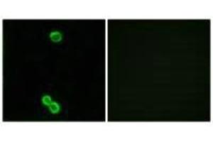 Immunofluorescence analysis of MCF-7 cells, using RPL3L antibody. (RPL3L Antikörper)