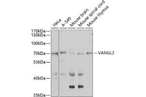 Western blot analysis of extracts of various cell lines, using V antibody (ABIN6132779, ABIN6150054, ABIN6150055 and ABIN6223794) at 1:1000 dilution. (VANGL2 Antikörper  (AA 1-110))
