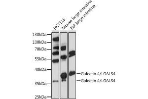 Western blot analysis of extracts of various cells, using Galectin 4/LG antibody (ABIN7267339) at 1:1000 dilution. (GAL4 Antikörper  (AA 1-100))