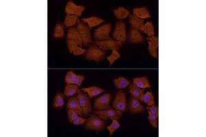 Immunofluorescence analysis of A-549 cells using PSMC5 Rabbit mAb (ABIN7269585) at dilution of 1:50 (40x lens). (PSMC5 Antikörper)