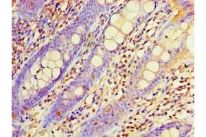 Immunohistochemistry of paraffin-embedded human colon tissue using ABIN7162957 at dilution of 1:100 (EHHADH Antikörper  (AA 1-723))