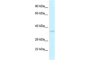 Western Blot showing ALKBH1 antibody used at a concentration of 1 ug/ml against Fetal Kidney Lysate (ALKBH1 Antikörper  (N-Term))