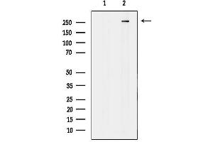 Western blot analysis of lysates from COLO205, using MAP1A Antibody. (MAP1A Antikörper  (Internal Region))