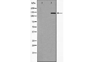 Western blot analysis of extracts of Jurkat, using DCTN1 antibody. (Dynactin 1 Antikörper  (C-Term))