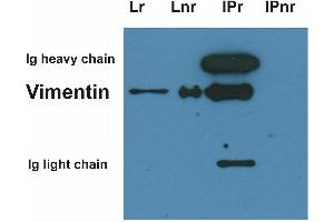 Immunoprecipitation of vimentin from HeLa cell lysate by antibody VI-10 (Vimentin Antikörper)