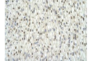 Immunohistochemistry (IHC) image for anti-TAF15 RNA Polymerase II, TATA Box Binding Protein (TBP)-Associated Factor, 68kDa (TAF15) (N-Term) antibody (ABIN2778851)