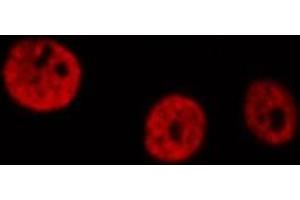 ABIN6266915 staining HeLa  cells by IF/ICC. (DDIT3 Antikörper  (N-Term))