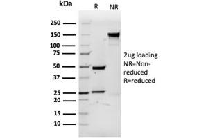 SDS-PAGE (SDS) image for anti-CD3 epsilon (CD3E) (AA 23-119) antibody (ABIN6941027)