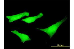 Immunofluorescence of monoclonal antibody to SYNE2 on HeLa cell. (SYNE2 Antikörper  (AA 6702-6799))