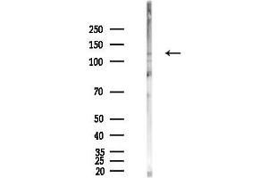 anti-Pumilio Homolog 1 (PUM1) (Internal Region) antibody