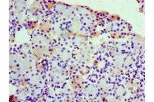 Immunohistochemistry of paraffin-embedded human pancreatic tissue using ABIN7142800 at dilution of 1:100 (RPL3 Antikörper  (AA 1-115))