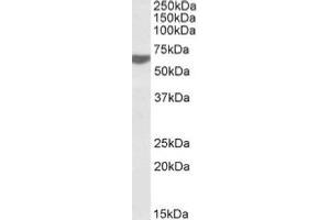 AP20110PU-N RAP1 antibody staining of Human Tonsil lysate at 0. (RAP1 Antikörper  (C-Term))