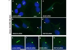 Confocal images from flat mount mouse retina samples at different postnatal ages showing the peripheral or central areas of RPE. (ARL13B Antikörper  (C-Term))